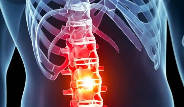 A Cura da Lesão Medular 2025 com a Polilaminina