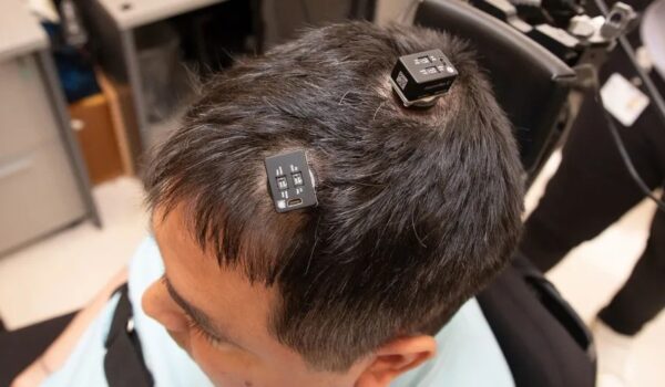 Implante cerebral com IA permite que tetraplégico sinta e controle a mão de outra pessoa!